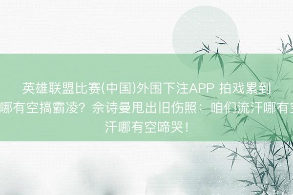英雄联盟比赛(中国)外围下注APP 拍戏累到没饭吃哪有空搞霸凌?佘诗曼甩出旧伤照:咱们流汗哪有空啼哭!